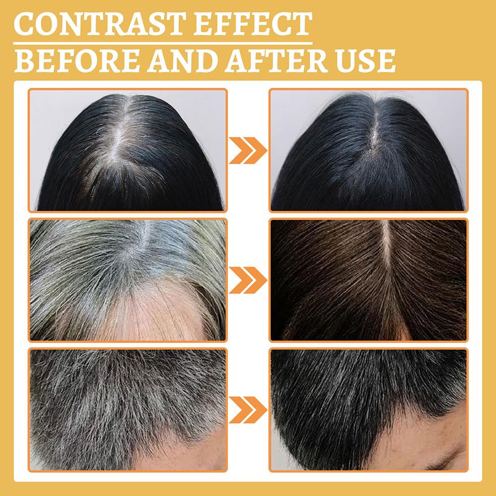 1/2 Buah Minyak Serum Penumbuh - Hair Care Natural Products ulasan dan harga