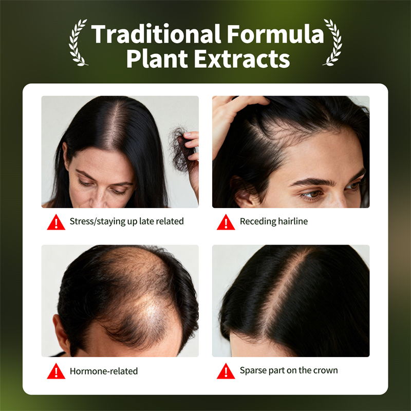 Set Perawatan Rambut Alami Usm - Hair Care Natural Products ulasan dan harga